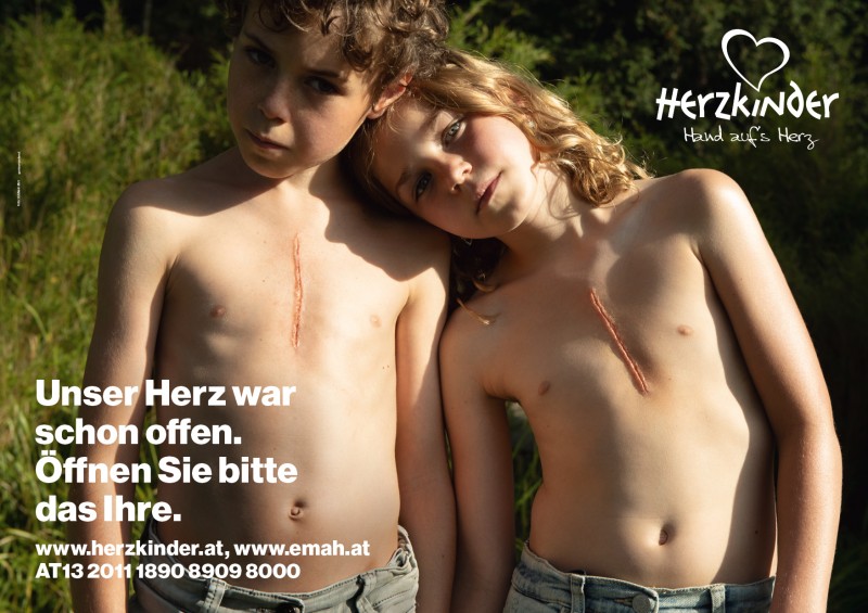 Herzkinder_Kampagne-2021-420x297-16gb1zu8_RZ2
